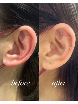 シロ(silo.)/耳つぼ