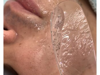 リメイククリニカルビューティー(Remake clinical beauty)/頑固なメンズヒゲ脱毛