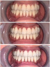 ライトビューティー 池袋店(LightBeauty)/症例写真