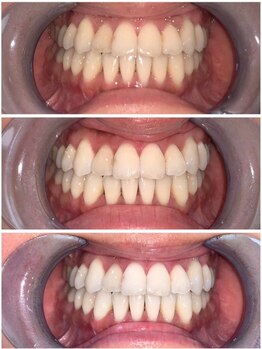 ライトビューティー 池袋店(LightBeauty)/症例写真