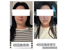ミューク(mjuk.)の雰囲気（【小顔セラピー】お顔の土台から整えて、お顔をコンパクトに！）