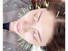 フジ鍼療所