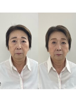 パーソナルサンフラワー(PersonalSunflower)/お客様ヘアメイクBefore/After