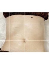 ベリンダ 中崎町店(BELINDA)/【最新マシンケア】左のみ施術