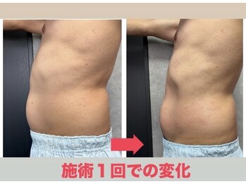 トロイカ(troika)/1回の施術でも効果を実感♪