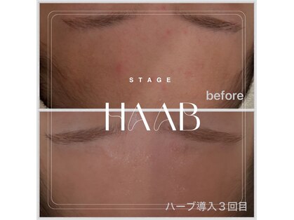 ステージ(Stage)の写真
