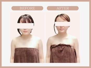 スリムライン 秋田店(The Slim Line)/before→after