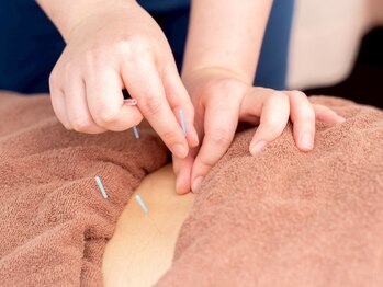 横浜杉田鍼灸院 深部整体院/男女関わらず増えている腰痛改善