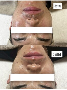 ビズビズ(bisebise)/60万人の実績！改善率にこだわる