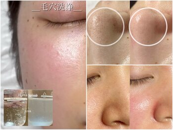 エトレ(ETOLE)の写真/ざらつき黒ずみに毛穴洗浄＜ハイドロスプラッシュ＞毛穴に溜まった皮脂汚れを徹底ケア★メンズも清潔感UP