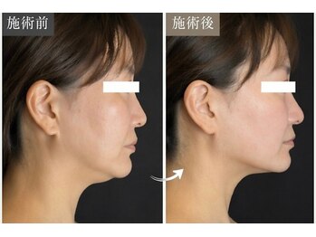エミニナル(EMININAL)の写真/たるみは顔だけの問題ではありません。背中から変える本格全身コルギ