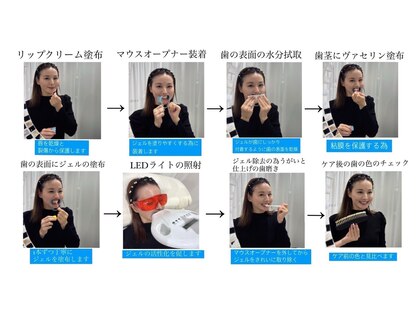 ホワイトニングショップ 尾道店(WHITENING SHOP)の写真