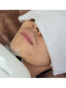 インスティンクトネイルズ(INSTINCT Nails)/メンズ脱毛☆ヒゲ脱毛/毛穴ケア