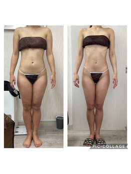 アミナス 渋谷店(AMINAS)/短期集中2回から始めませんか?