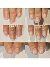 ニコプラス(NICO+)/自爪育成中