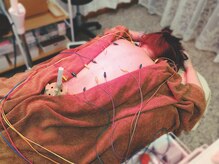 はりキュア(はりCure)の雰囲気（はりきゅう施術）
