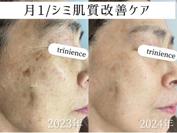 トリニエンス 新宿店(TRINIENCE)/50代/シミケア/肌代謝ケア