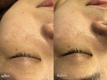 フルール(Fleur)/◆目元美容◆