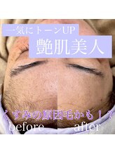 シック(Chic)/マリムーブフェイシャルワックス