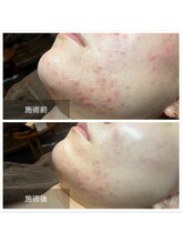 ブランスパ(Bulan Spa)/初のエステで感動体験☆☆