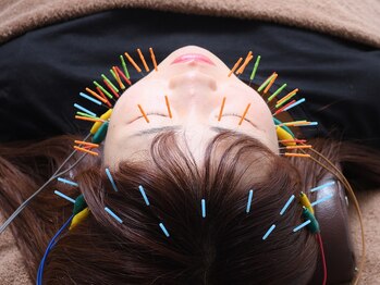 ウル鍼灸整骨院/美容鍼(プレミアム)