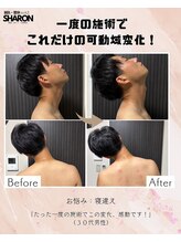 トゥーアズ シャロン(toAZ SHARON)/【鍼灸/首可動域不全】