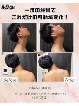 トゥーアズ シャロン(toAZ SHARON)/【鍼灸/首可動域不全】