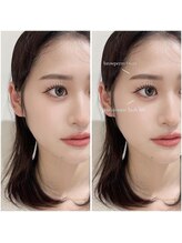 ミー 大宮一の宮通り店(me.)/アイブロウ×パリジェンヌ