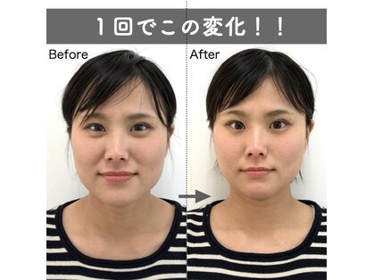 美容整体すこやかの写真