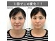 美容整体すこやかの写真