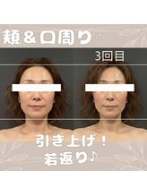 ラフィズム 竹ノ塚店(Raphism)/若見えにも♪