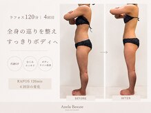 アネラボーテ(Anela Beaute)の雰囲気（＼大人気ラフォスボディ／疲労改善・ダイエット・ブライダル）