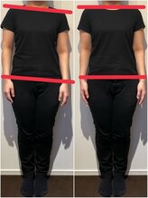 スイスパ(翠SUI SPA)/【骨盤矯正】歪み Before→After