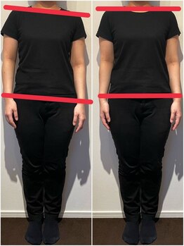 スイスパ(翠SUI SPA)/【骨盤矯正】歪み Before→After