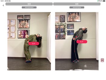 ナオル整体 浅草院(NAORU整体)/20代女性【腰痛・痺れ】