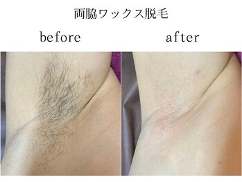 サロン ド アピール(salon de APPEAL)/