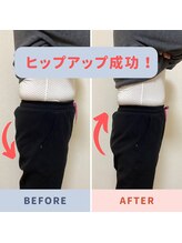 バンビ ビューティーラボ/お尻のシルエットにも…