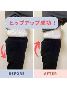 バンビ ビューティーラボ/お尻のシルエットにも…