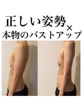 サロンツキ(salon tuki)/【バストケア】症例