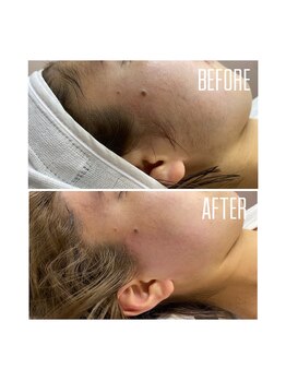 ホワイトワックス 京都四条烏丸(WHITE WAX)/揉み上げスッキリ♪