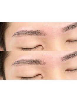 メンズフェイシャル