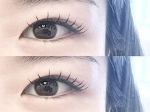 エム アイデザイン(M.eyedesign)/＆healthy(アンドヘルシー)140本