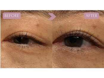 サロンドプッチイ(SalondoPutti)/NOBIRUラッシュリフト