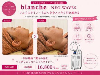 オリエンタルローザ 表参道(Oriental Rosa)/マイクロ波で小顔＆顎下すっきり