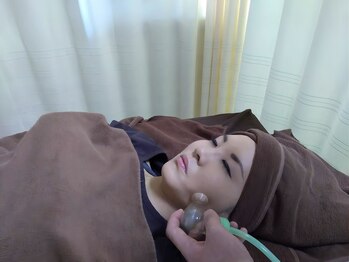 泉町鍼灸整骨院/フェイシャルカッピング