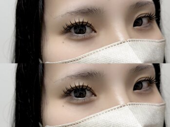 シリウス バイ ティアラ(SIRIUS by Tiara)/バインド付け放題