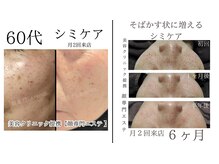 月2回又は、月１回のご来店でOK！メニューはオーダーメイド制