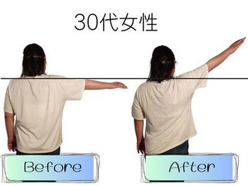 ビールーム 赤羽店(B-ROOM)/肩こりの悩み30代女性(右)