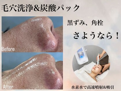 ヨク 梅田(YOKU)の写真