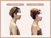 スリムライン 秋田店(The Slim Line)/before→after